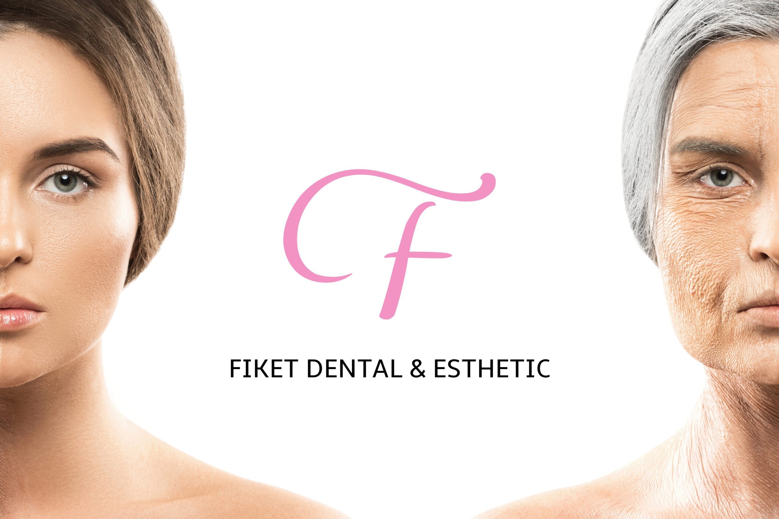 Usporedba poslije i prije botoksa a zsredini logo Fiket Dental & Esthetic